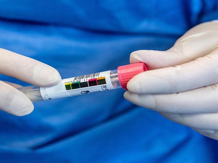 Eine Virologin hält eine Probe in der Hand. Foto: Robert Michael/dpa-Zentralbild/dpa/Symbolbild