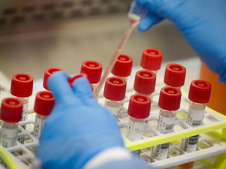 Etliche Labors weltweit forschen derzeit an Impfstoffen gegen Covid-19. In einem Forschungsinstitut in Seattle wird bereits eine Testsubstanz an einem Freiwilligen erprobt.