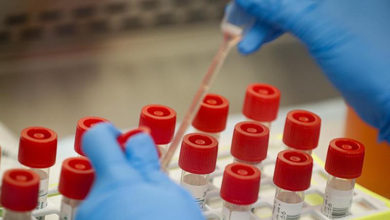 Etliche Labors weltweit forschen derzeit an Impfstoffen gegen Covid-19. In einem Forschungsinstitut in Seattle wird bereits eine Testsubstanz an einem Freiwilligen erprobt. Etliche Labors weltweit forschen derzeit an Impfstoffen gegen Covid-19. In einem Forschungsinstitut in Seattle wird bereits eine Testsubstanz an einem Freiwilligen erprobt.