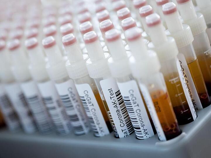 Corona-Antikörper-Tests haben an Schulen und Sachsen keine Infektionen gezeigt.