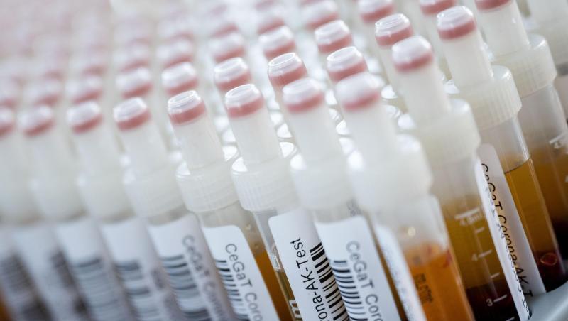 Corona-Antikörper-Tests haben an Schulen und Sachsen keine Infektionen gezeigt. Corona-Antikörper-Tests haben an Schulen und Sachsen keine Infektionen gezeigt.