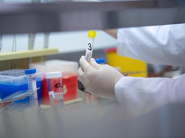 Eine Frau zeigt in einem Labor einen Test für das neuartige Coronavirus. Foto: Sebastian Gollnow/dpa/Symbolbild