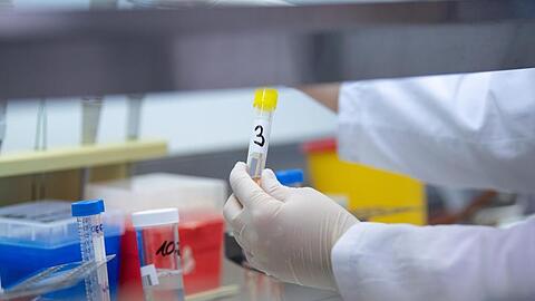 Eine Frau zeigt in einem Labor einen Test für das neuartige Coronavirus. Foto: Sebastian Gollnow/dpa/Symbolbild