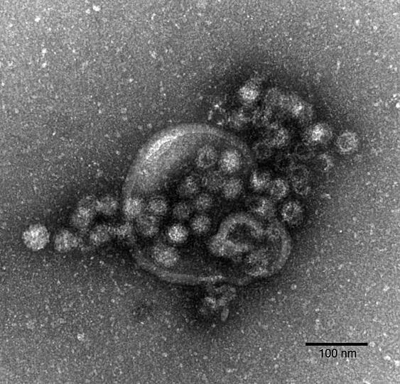 Im laufenden Jahr seien im Freistaat schon mehr als 13.800 Fälle von Norovirus-Erkrankungen registriert worden (Symbolbild)