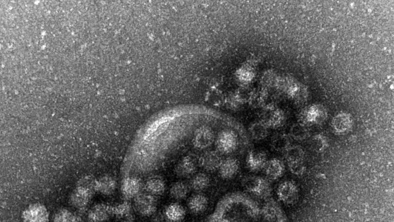 Im laufenden Jahr seien im Freistaat schon mehr als 13.800 Fälle von Norovirus-Erkrankungen registriert worden (Symbolbild)