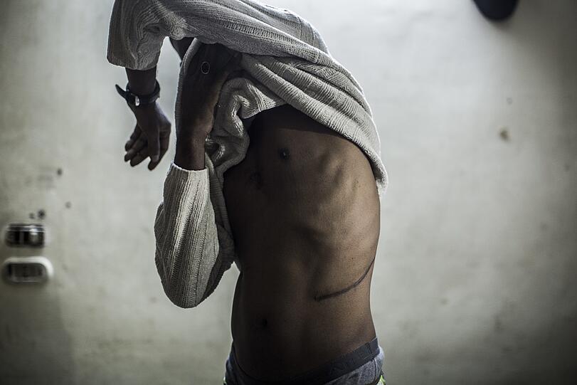 04.10.2017: Haider zeigt in Kairo (Ägypten) eine Narbe von einer Nierenoperation. Der Sudanese hat nach eigenen Angaben eine Niere an Organhändler verkauft, um mit dem Erlös nach Europa zu flüchten, das Geld nach der Operation aber nie erhalten.