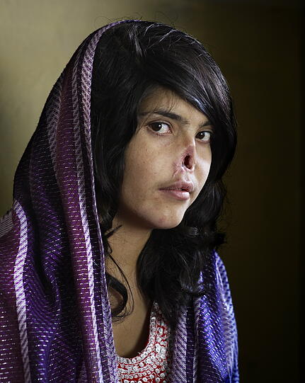 Mit dem schockierenden Bild einer verstümmelten Afghanin hat die südafrikanische Fotografin Jodi Bieber (Institute for Artist Management/Goodman Gallery) den World Press Photo Award 2010 gewonnen.