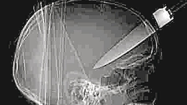 Schockierende Röntgenaufnahme: Das Küchenmesser ist tief in den Schädel des Jugendlichen eingedrungen.Foto: dpa Schockierende Röntgenaufnahme: Das Küchenmesser ist tief in den Schädel des Jugendlichen eingedrungen.Foto: dpa