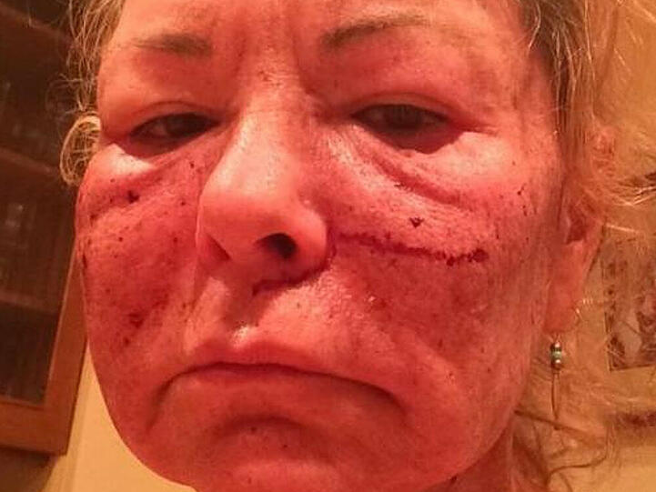 Dieses Bild hat Roseanne Barr mittlerweile von ihrer Twitter-Seite wieder entfernt