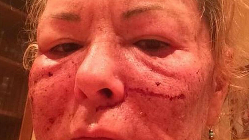 Dieses Bild hat Roseanne Barr mittlerweile von ihrer Twitter-Seite wieder entfernt Dieses Bild hat Roseanne Barr mittlerweile von ihrer Twitter-Seite wieder entfernt