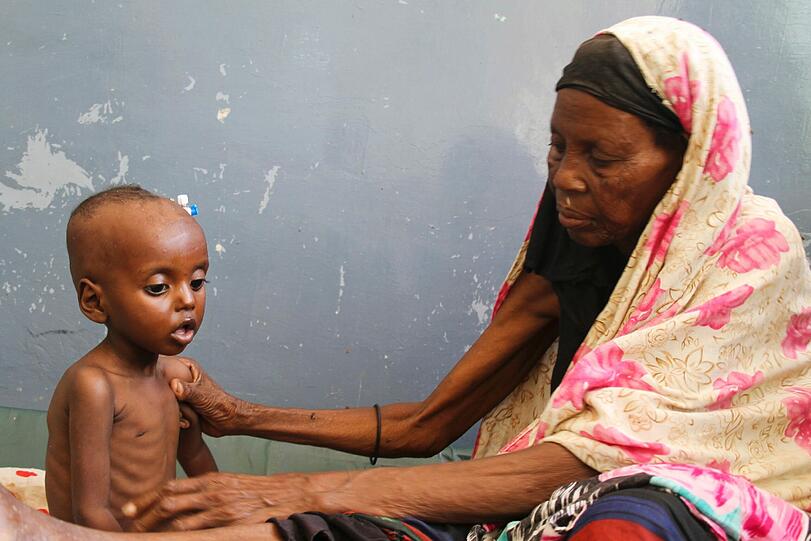 Der sorgenvolle Blick einer Mutter: Amina Ibrahim schaut prüfend auf ihre Tochter Nasteho Ali. Die Einjährige wird in einer Klinik in Mogadischu versorgt &ndash; sie ist unterernährt.