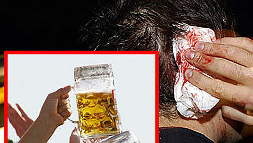Lebensgefährliche Attacke: Am Kopf des Opfers klafft eine blutende Wunde nach einem Angriff mit einem Bierkrug. Lebensgefährliche Attacke: Am Kopf des Opfers klafft eine blutende Wunde nach einem Angriff mit einem Bierkrug.
