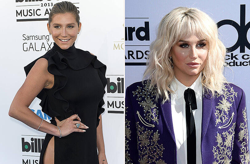 Auch die Sängerin Kesha erscheint bei den Billboard Music Awards 2016 (r.) mit einem neuen Gesicht.