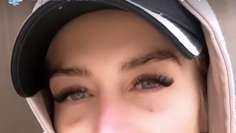 Verena Kerth war bei der Eigenblutbehandlung Verena Kerth war bei der Eigenblutbehandlung