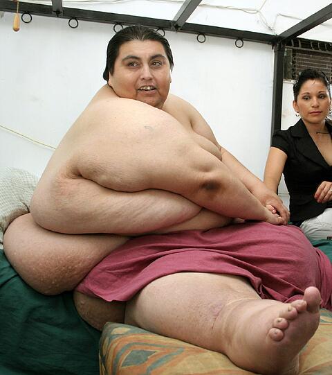 Manuel Uribe hatte in den letzten Jahren über 200 Kilo abgespeckt. Am Montag kam der fettleibige Mexikaner mit Herzproblemen ins Krankenhaus, wo der schließlich verstarb.