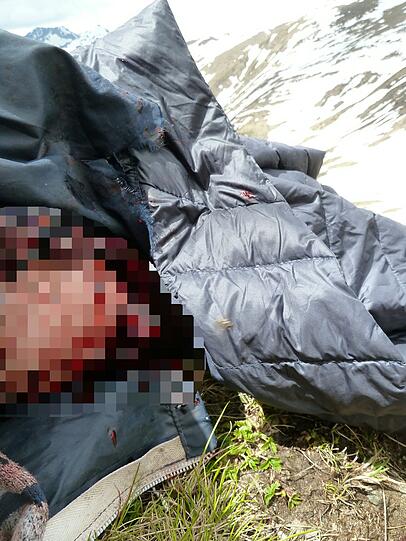 Bauer stoppte die Blutung am Bein notdürftig mit einem Strumpf.