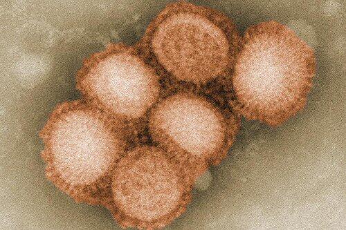 Der Schweingrippen-Virus