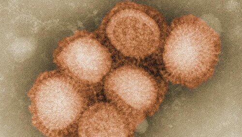 Der Schweingrippen-Virus Der Schweingrippen-Virus
