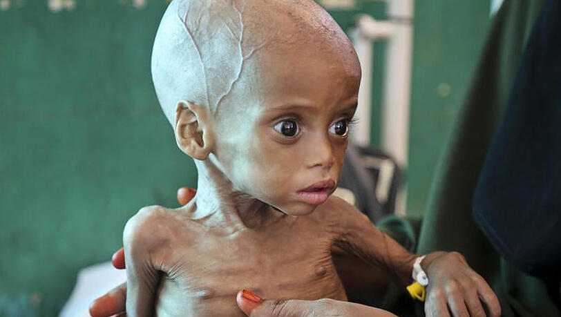 20 Millionen Menschen in vier Ländern sind vom Hungertod bedroht. 20 Millionen Menschen in vier Ländern sind vom Hungertod bedroht.