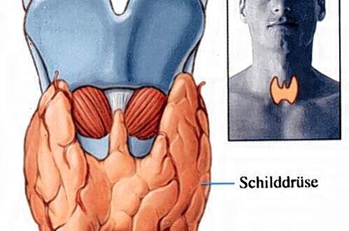 Jodmangel ist die häufigste Ursache für Fehlbildungen der Schilddrüse.