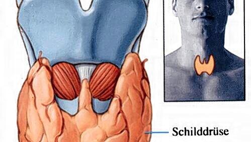 Jodmangel ist die häufigste Ursache für Fehlbildungen der Schilddrüse. Jodmangel ist die häufigste Ursache für Fehlbildungen der Schilddrüse.