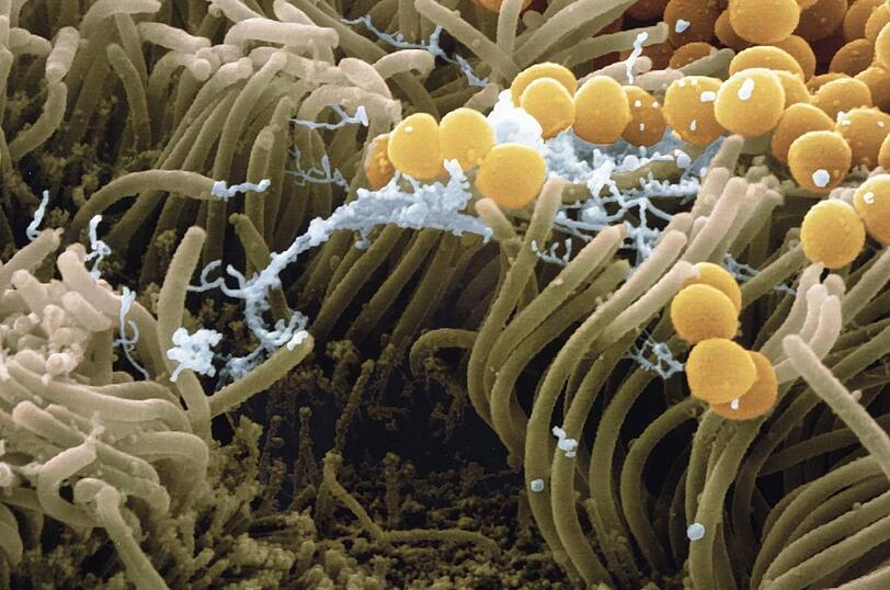 So sehen MRSA-Erreger unter dem Mikroskop aus.
