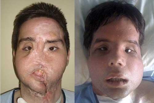 Vor (li.) und nach der Operation