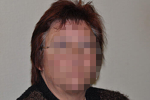 Das Opfer: Patricia R. (48) trug Schädelbrüche davon.