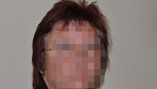 Das Opfer: Patricia R. (48) trug Schädelbrüche davon. Das Opfer: Patricia R. (48) trug Schädelbrüche davon.