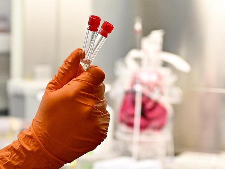 Laboruntersuchungen zur Abklärung des Coronavirus. Foto: Hans Punz/APA/dpa