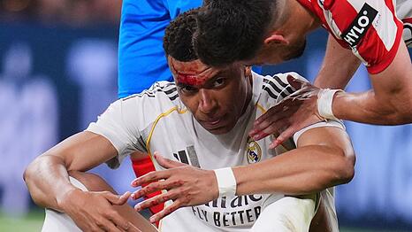 Kylian Mbapp&eacute; wurde im Spiel gegen Girona im Gesicht verletzt. (Archivbild)