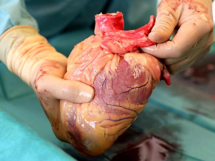 Ein Transplantationsmediziner hält in der Pathologie des Südstadt-Klinikums ein Herz in den Händen.