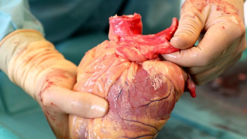 Ein Transplantationsmediziner hält in der Pathologie des Südstadt-Klinikums ein Herz in den Händen. Ein Transplantationsmediziner hält in der Pathologie des Südstadt-Klinikums ein Herz in den Händen.
