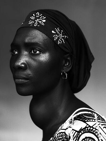Im Porträt: Eine Frau aus Guinea. An ihrem Hals hat sich ein großer Kropf gebildet.