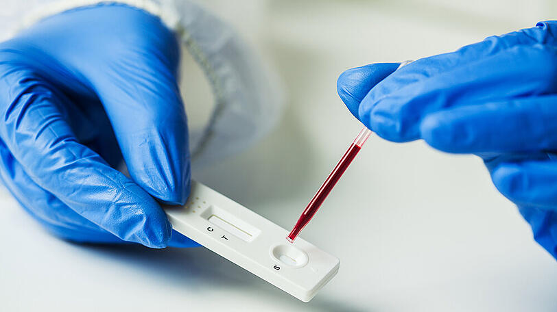 Antigen-Schnelltests sind bislang medizinisch geschultem Personal vorbehalten.