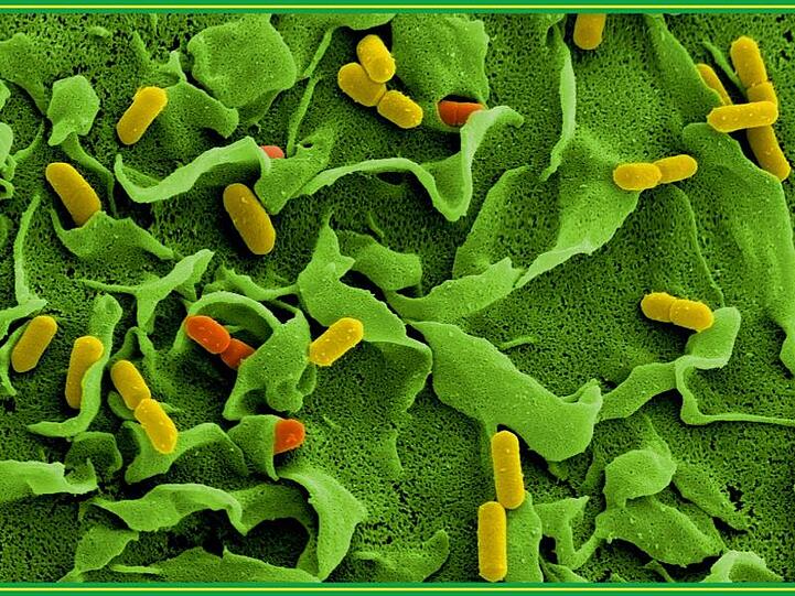 Elektronenmikroskopische Aufnahmen von Listerien (Listeria monocytogenes). Foto: Manfred Rohde/Helmholtz-Zentrum für Infektionsforschung/dpa