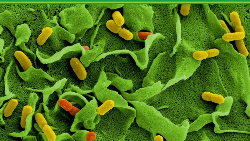 Elektronenmikroskopische Aufnahmen von Listerien (Listeria monocytogenes). Foto: Manfred Rohde/Helmholtz-Zentrum für Infektionsforschung/dpa Elektronenmikroskopische Aufnahmen von Listerien (Listeria monocytogenes). Foto: Manfred Rohde/Helmholtz-Zentrum für Infektionsforschung/dpa