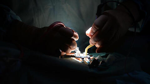 Nach Angaben der gesetzlichen Krankenkassen ist die Zahl der medizinischen Behandlungsfehler 2016 zurückgegangen.