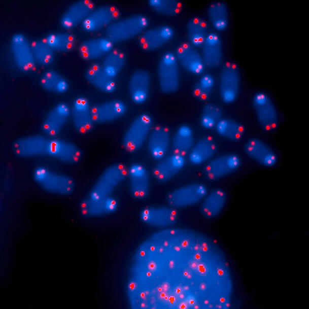 Telomere sind "Schutzkappen" an den Enden von Chromosomen (kleine rote Punkte im Bild) Telomere sind "Schutzkappen" an den Enden von Chromosomen (kleine rote Punkte im Bild)