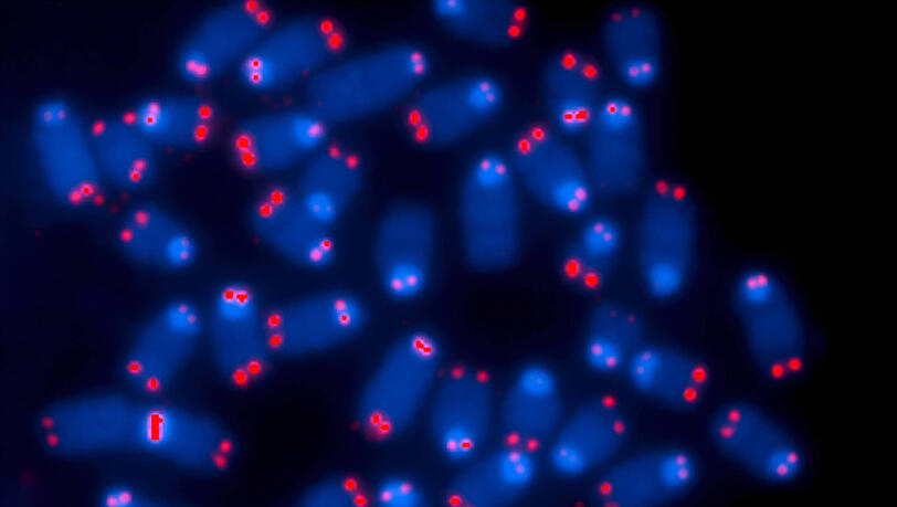 Telomere sind "Schutzkappen" an den Enden von Chromosomen (kleine rote Punkte im Bild)