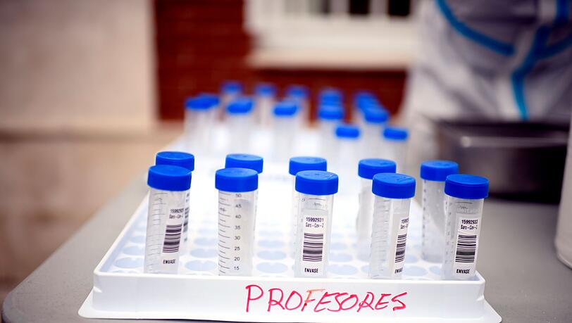 Blick auf PCR-Speichelproben in der internationalen Schule "Alameda de Osuna". Die Schule beginnt in Zusammenarbeit unter anderem mit dem Labor "Synlab".
