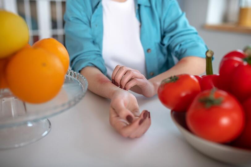 Auch Kreuzallergien k&ouml;nnen nach dem Verzehr von Tomaten auftreten. Vor allem, wenn Betroffene an einer Birkenpollen-Allergie leiden, reagieren sie oftmals empfindlich nach dem Konsum von Tomaten. Denn die Allergene &auml;hneln den Inhaltsstoffen der Tomate und k&ouml;nnen &auml;hnliche Symptome hervorrufen, etwa Juckreiz, Schwellungen im Mundraum oder Magen-Darm-Probleme.