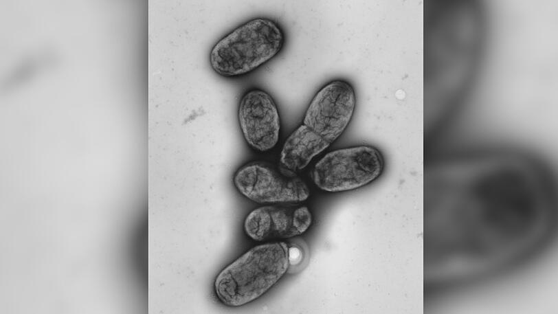 Anders als bisher angenommen wurde die Pest bei der großen Pest-Welle im 14. Jahrhundert nicht durch Ratten, sondern durch Menschenflöhe übertragen. Das fand eine norwegische Forschergruppe der Universität Oslo kürzlich heraus.