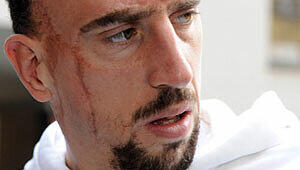 Sportministerin Jouanno ist gegen ein Comeback von Ribery. Sportministerin Jouanno ist gegen ein Comeback von Ribery.