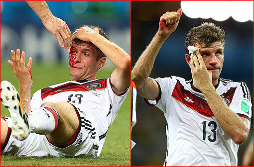 Einsatz bis zum Ende: Bei der letzten Aktion im Spiel erleidet Thomas Müller eine Platzwunde...