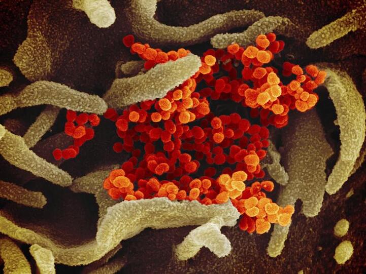 Eine elektronenmikroskopische Aufnahme zeigt das Coronavirus (SARS-CoV-2, orange), das aus der Oberfläche von im Labor kultivierten Zellen (grau) austritt.