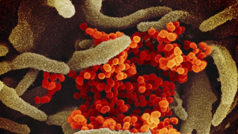 Eine elektronenmikroskopische Aufnahme zeigt das Coronavirus (SARS-CoV-2, orange), das aus der Oberfläche von im Labor kultivierten Zellen (grau) austritt. Eine elektronenmikroskopische Aufnahme zeigt das Coronavirus (SARS-CoV-2, orange), das aus der Oberfläche von im Labor kultivierten Zellen (grau) austritt.