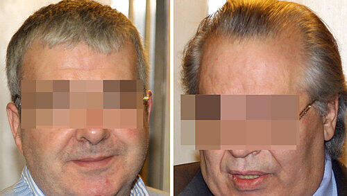 Die zwei angeklagten Bestatter: Fritz P. (54, links) aus Aschbach gestand die Tat, der Erlanger Michael S. (54, rechts) behauptete, dass Erwin W. (&dagger;43) noch lebt.