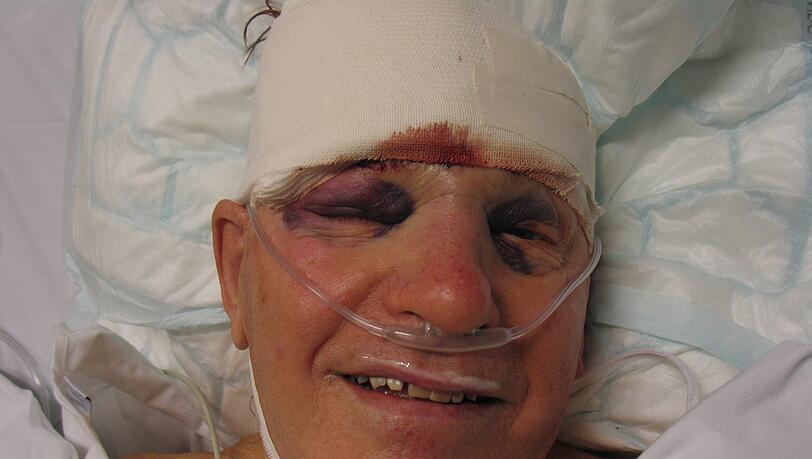 John G. ist außer Lebensgefahr. Der 85-Jährige liegt mit schweren Kopfverletzungen in der Klinik. Was am Dienstagabend passiert ist, kann er selbst kaum fassen. John G. ist außer Lebensgefahr. Der 85-Jährige liegt mit schweren Kopfverletzungen in der Klinik. Was am Dienstagabend passiert ist, kann er selbst kaum fassen.