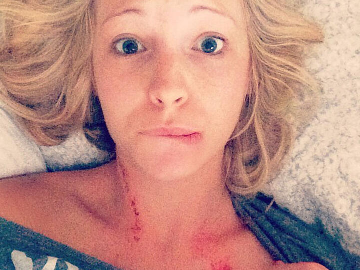 Candice Accola hat die Spuren ihres Jobs noch nicht beseitigt